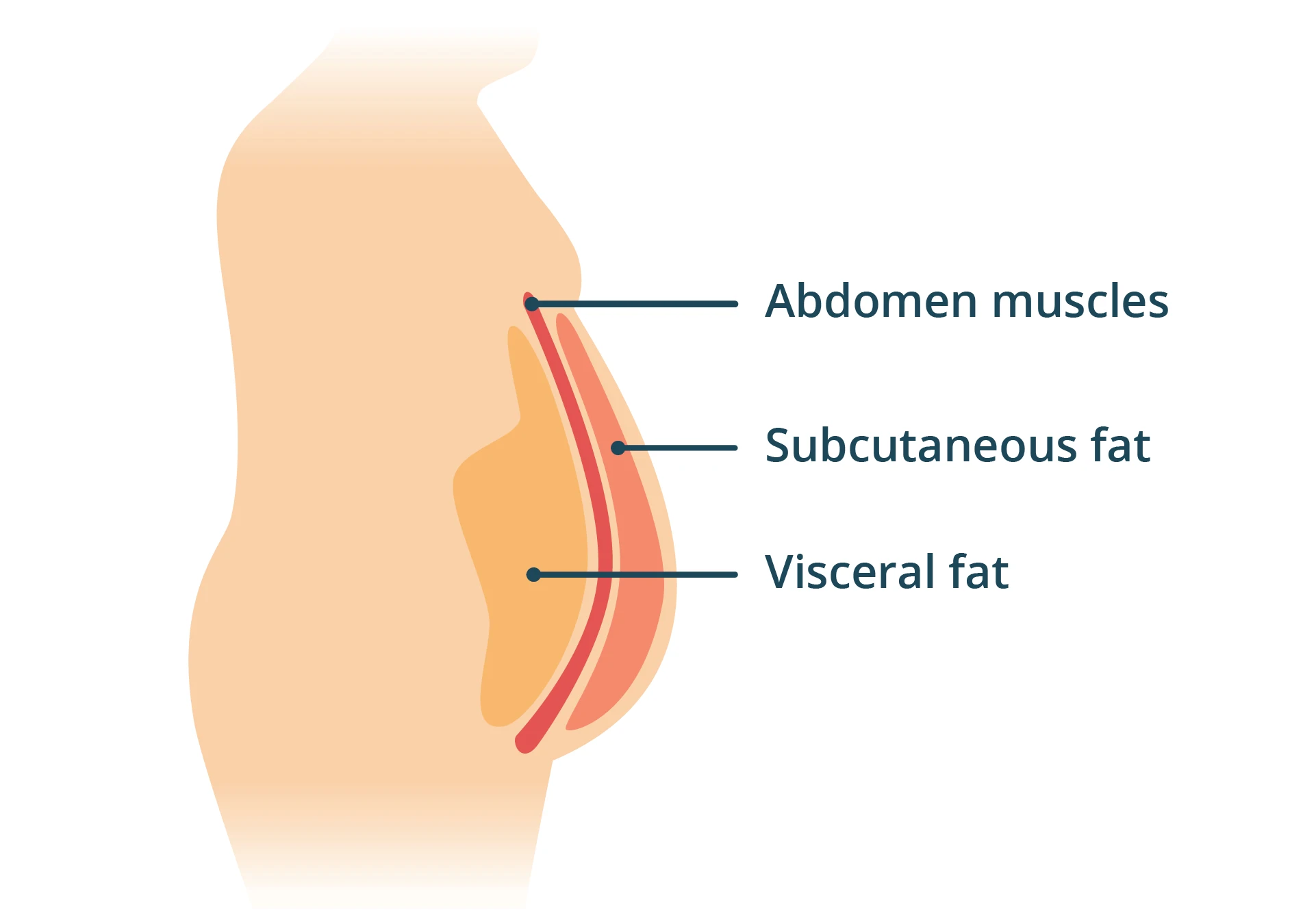 Body fat diagram showing different types of fat, reduced by Phix.